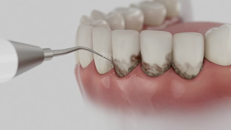 Reliable Teeth Cleaning And Checkup contractor in Monona County County, IA by Dentist Open Now